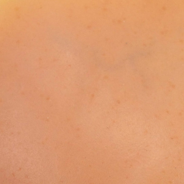 light-freckles-veins.jpg